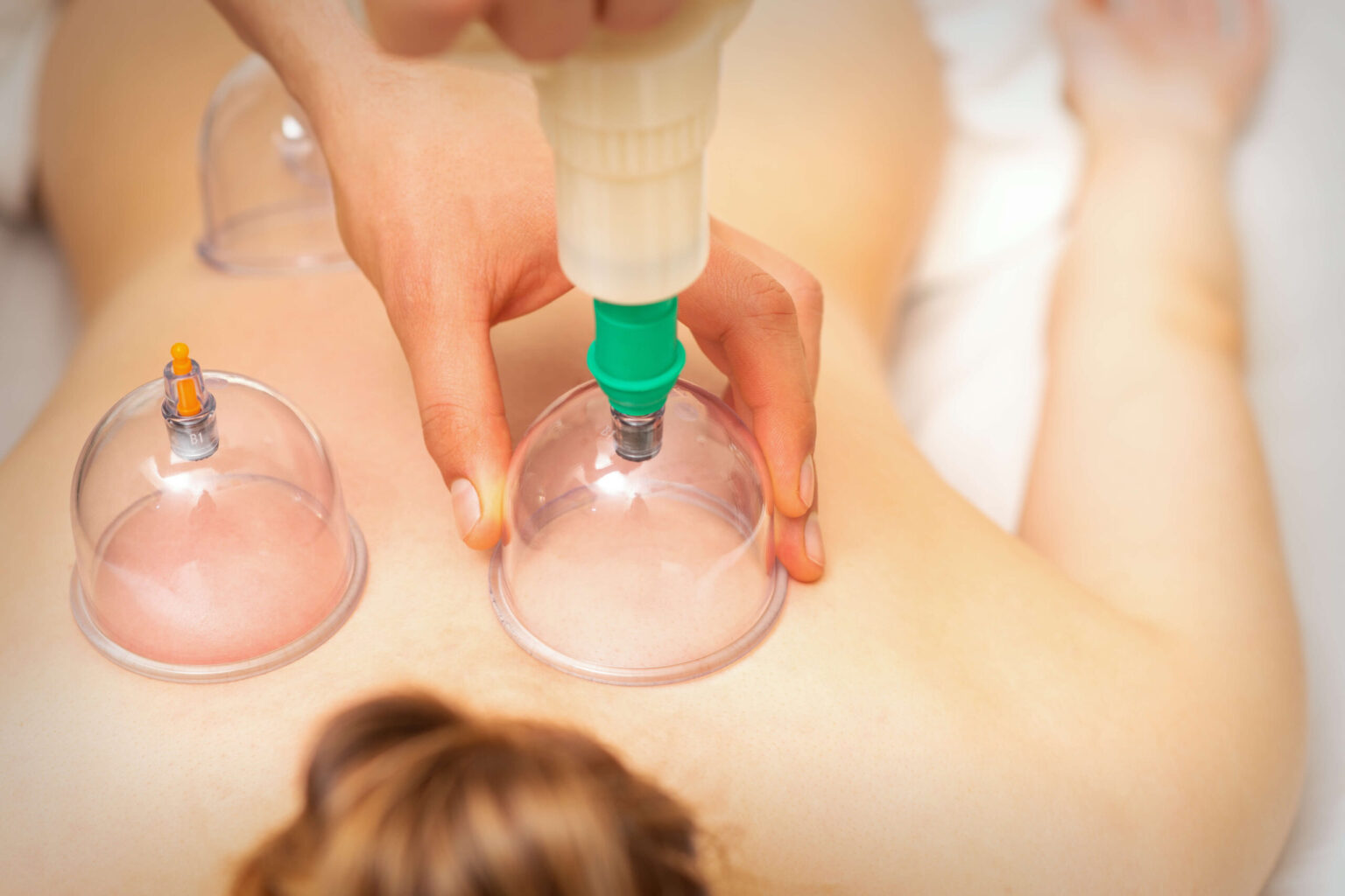 SmartLipo vs. Traditional Liposuction: What Really Makes One Safer?